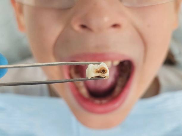 Best Cracked Tooth Emergency Dentist  in Malabar, FL